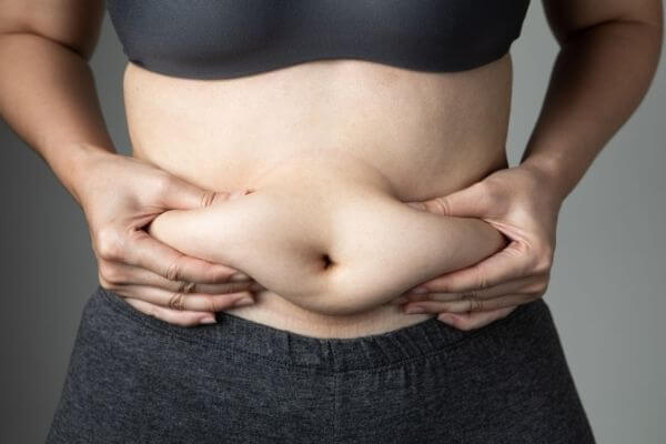 subcutaneous fat- belly fat